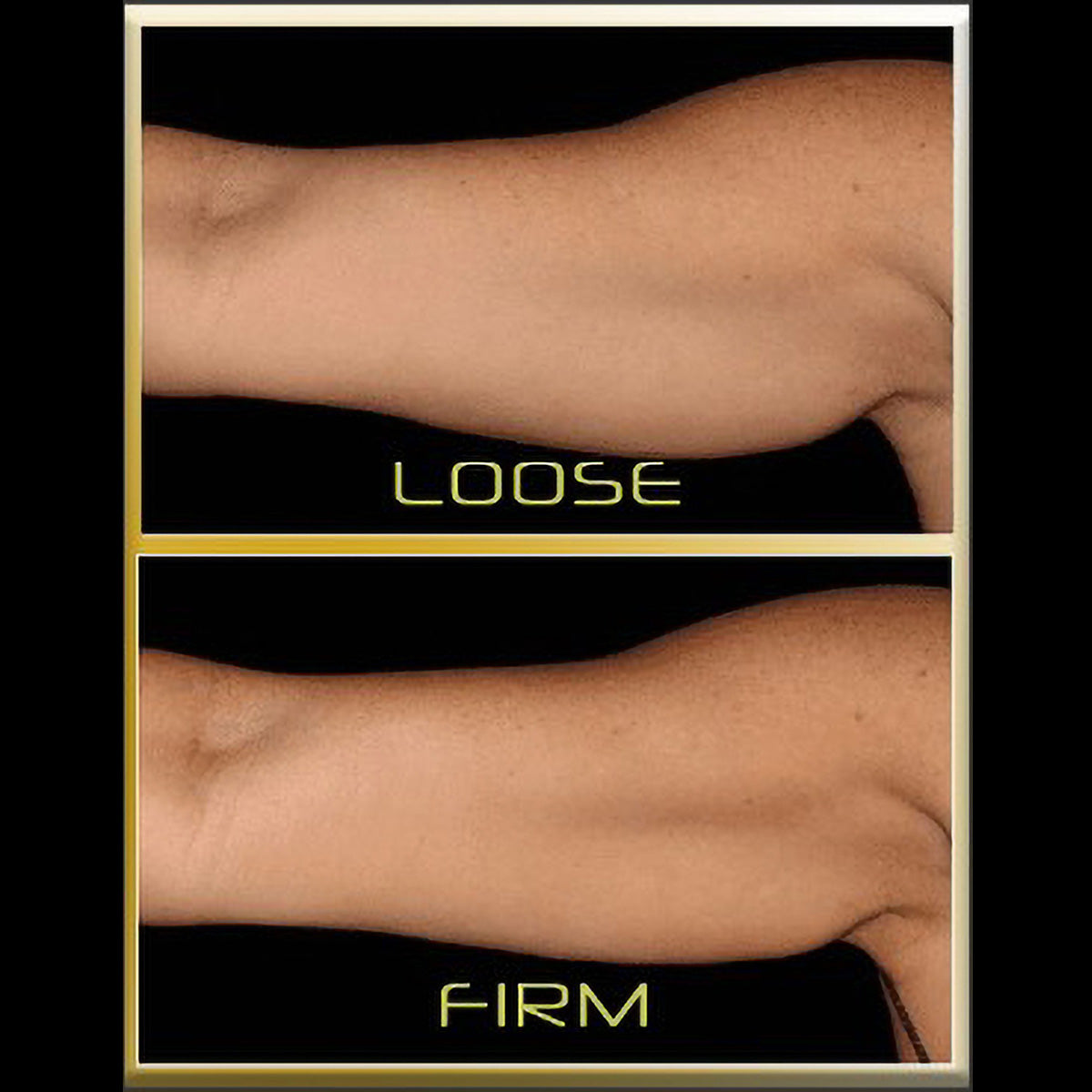 Underarm Toner - image 5