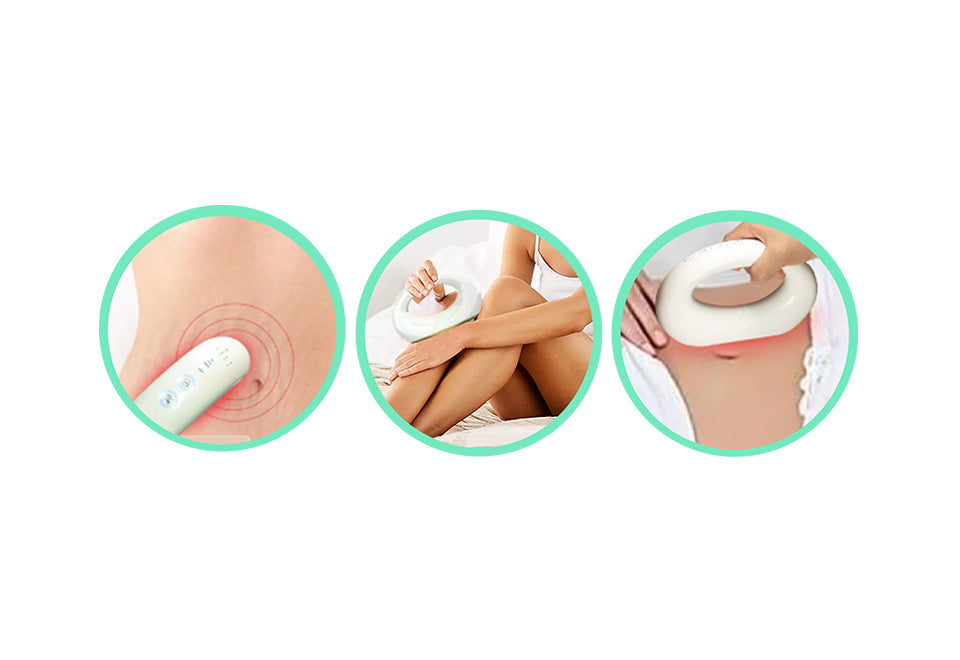Cordless Stretch Mark Minimizer - image 5