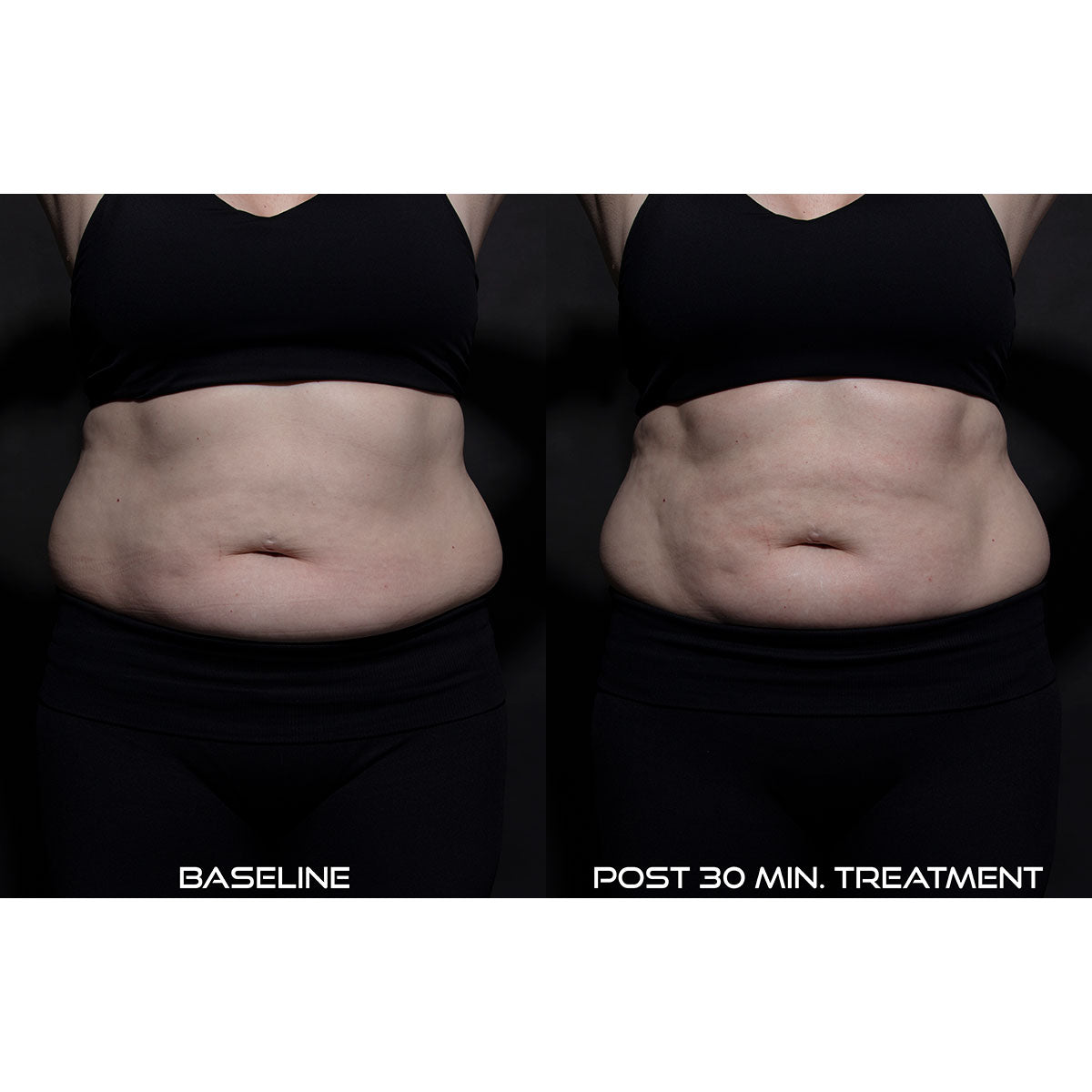 5-in-1 Body Contouring Device - image 5